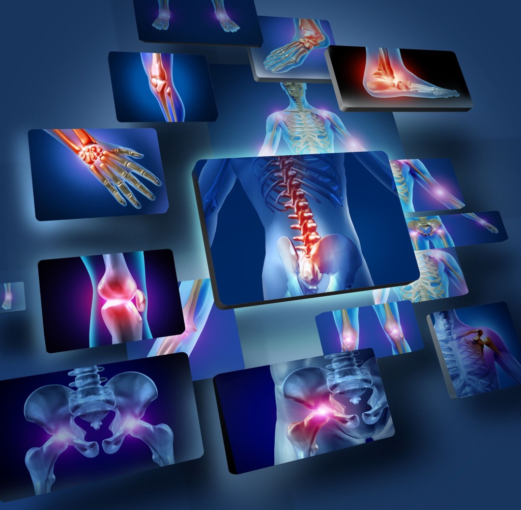 Randomised, Double-Blind, Parallel, Placebo-Controlled Study of Oral Glucosamine, Methylsulfonylmethane and their Combination in Osteoarthritis.
