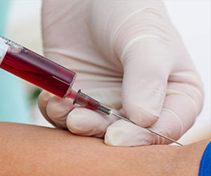Anemia